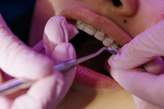 tratamiento de ortodoncia